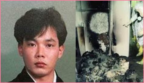 The Devastating Aftermath: Hisashi Ouchi's Autopsy Reveals Extent Of Radiation Damage